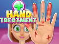 Permainan Hand Treatment